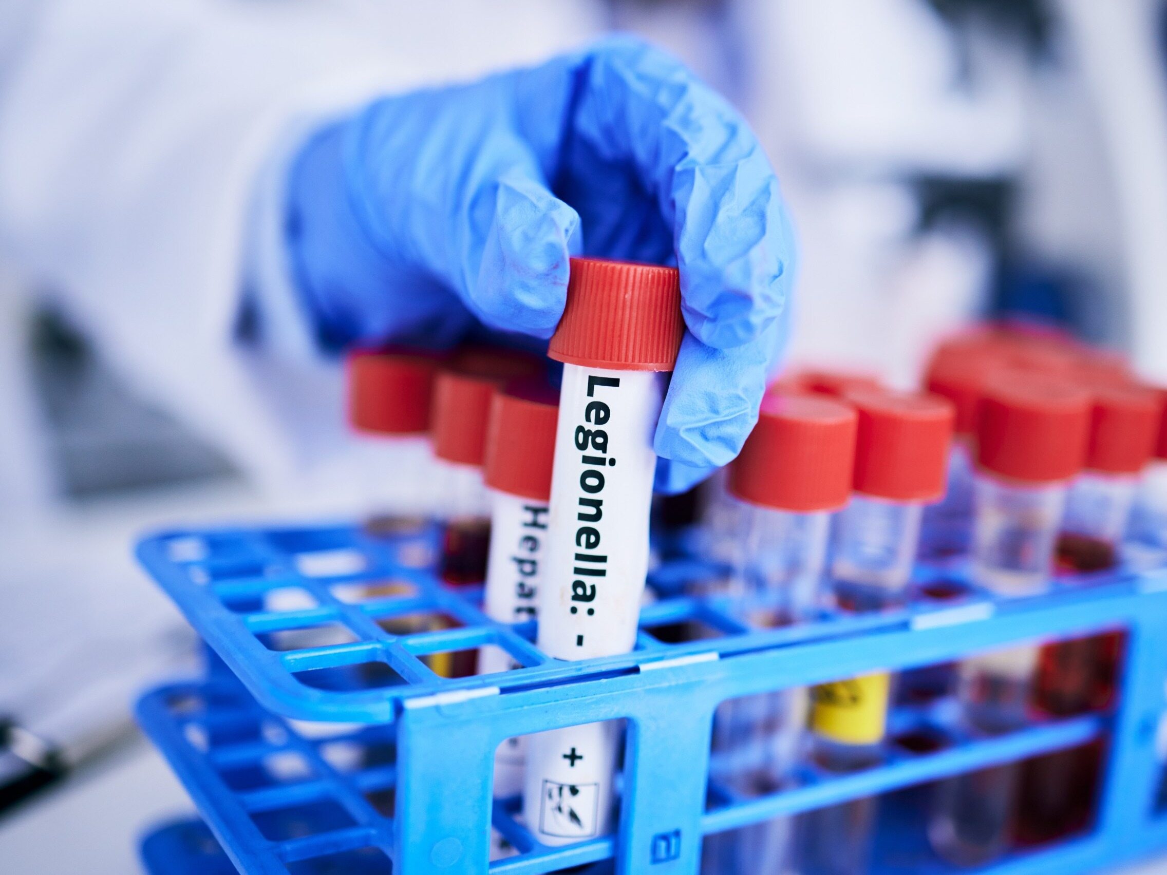 Legionella w Polsce. „Kreml próbował wywołać panikę i chaos wśród mieszkańców Podkarpacia”