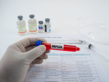 Nowy wariant mpox trudniejszy do wykrycia. WHO bije na alarm