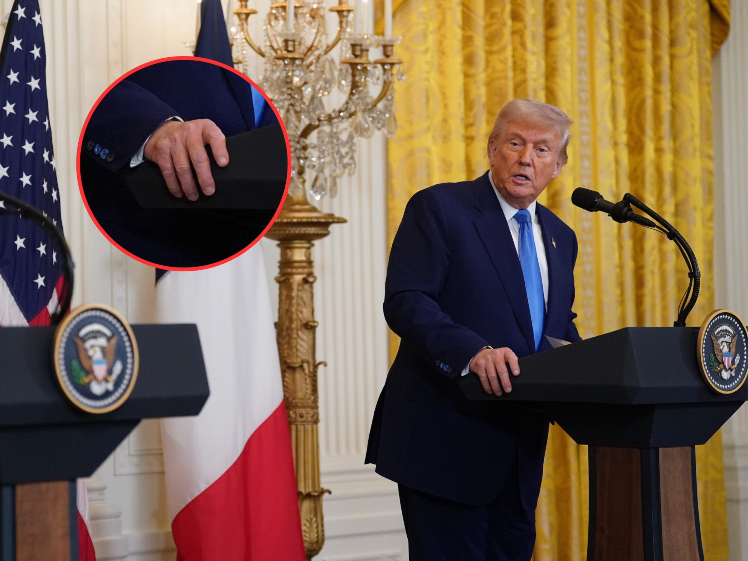 Tajemniczy siniak na dłoni Donalda Trumpa. To symptom większej choroby?