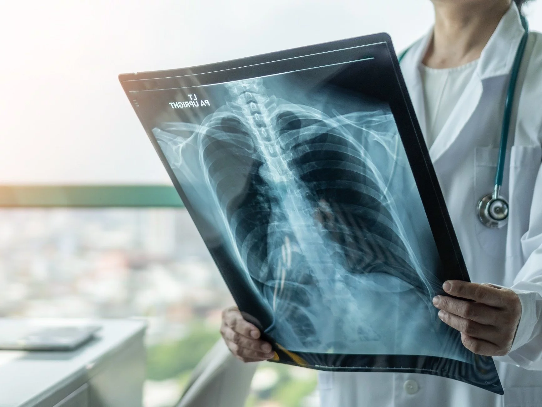 Ognisko gruźlicy w przedszkolu. Niemal dwieście osób diagnozowanych Ognisko gruźlicy w przedszkolu. Niemal dwieście osób diagnozowanych