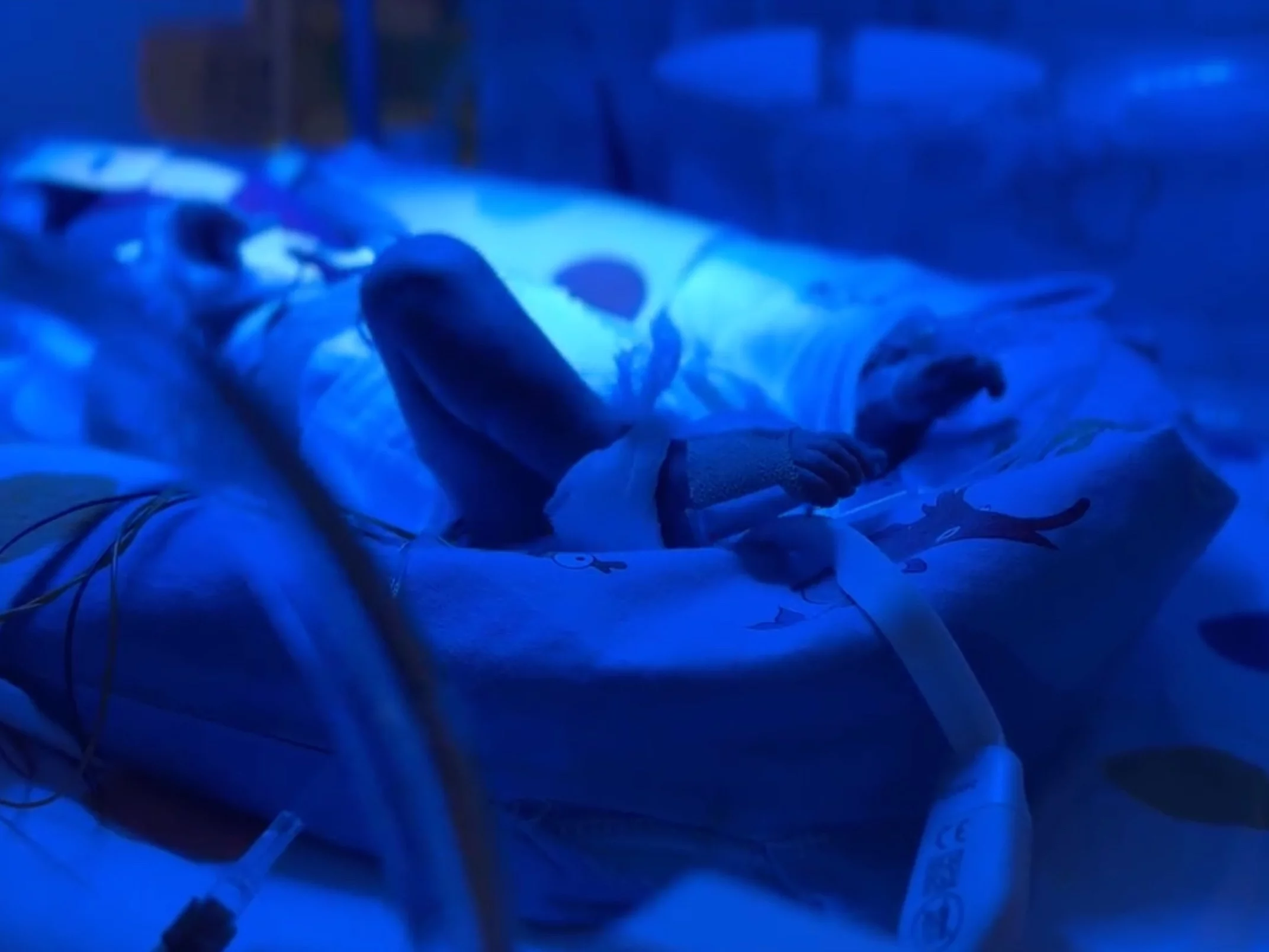 Taka ciąża zdarza się raz na 8 tysięcy. Niesamowity poród w szczecińskim szpitalu Taka ciąża zdarza się raz na 8 tysięcy. Niesamowity poród w szczecińskim szpitalu