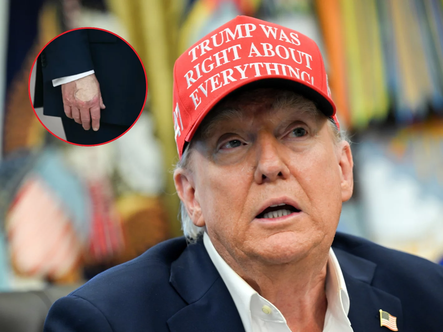 Niepokojące zdjęcia dłoni Trumpa. Biały Dom tłumaczy Niepokojące zdjęcia dłoni Trumpa. Biały Dom tłumaczy