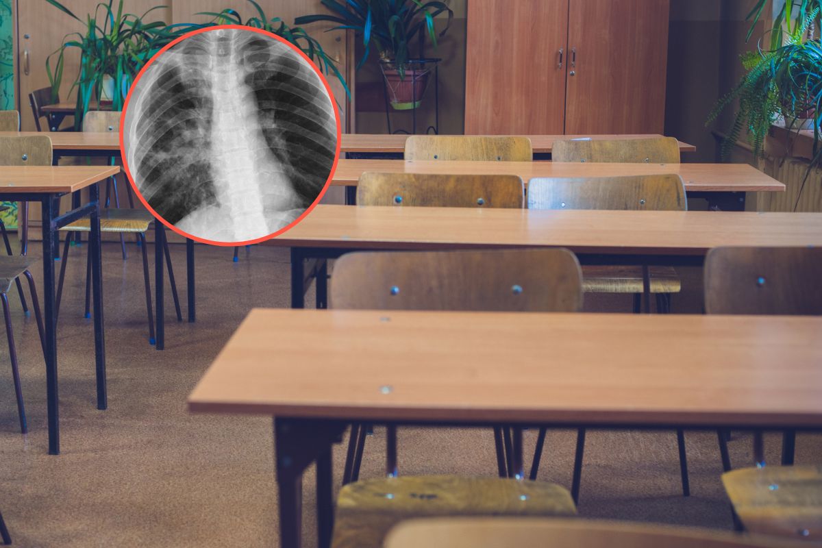 Gruźlica w warszawskiej placówce oświatowej. Są zakażone dzieci